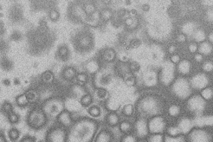 新型コロナウイルス感染症（COVID-19）について